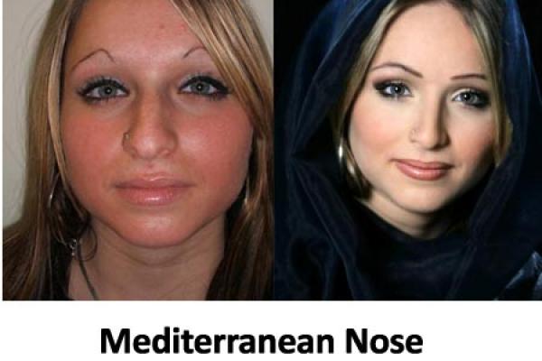 Mediterranean Nose